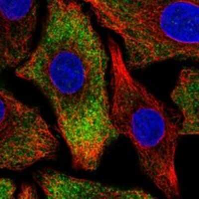 Immunocytochemistry/Immunofluorescence: PNPLA6 Antibody [NBP3-17292] - Staining of human cell line A549 shows localization to cytosol & endoplasmic reticulum.