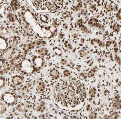 Immunohistochemistry-Paraffin: PNPLA6 Antibody [NBP1-80984] - Staining of human kidney shows strong nuclear and cytoplasmic positivity in cells in cells in tubules and cells in glomeruli.