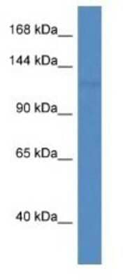 Western Blot: PNPLA6 Antibody [NBP1-74214] - Mouse Heart Lysate 1ug/ml Gel Concentration 6-18%