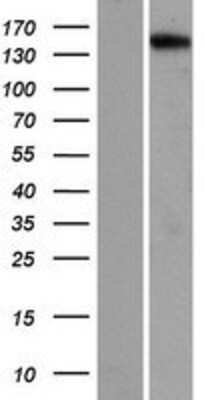 Western Blot: PNPLA6 Overexpression Lysate (Adult Normal) [NBP2-10163] Left-Empty vector transfected control cell lysate (HEK293 cell lysate); Right -Over-expression Lysate for PNPLA6.