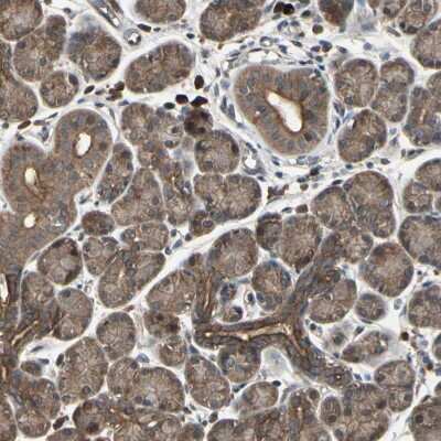 Immunohistochemistry-Paraffin: PNPLA7 Antibody [NBP1-91231] - Staining of human salivary gland shows moderate cytoplasmic positivity in glandular cells.