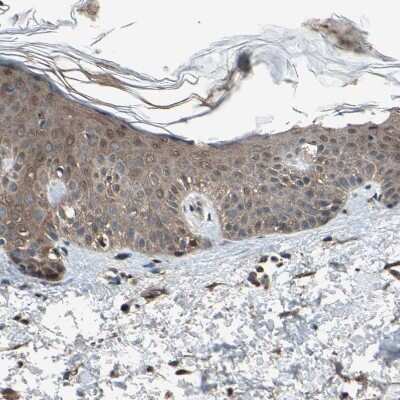Immunohistochemistry-Paraffin: PNPLA7 Antibody [NBP1-91231] - Staining of human skin shows weak to moderate cytoplasmic positivity in squamous epithelial cells.