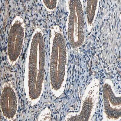 Immunohistochemistry-Paraffin: PNPLA7 Antibody [NBP1-91231] - Staining of human endometrium shows moderate cytoplasmic positivity in glandular cells.