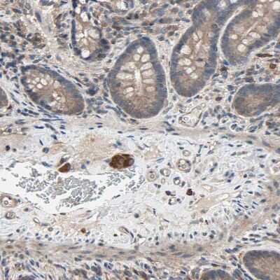 Immunohistochemistry-Paraffin: PNPLA7 Antibody [NBP1-91231] - Staining of human small intestine shows strong cytoplasmic positivity in peripheral ganglion.