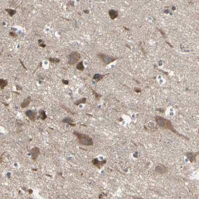 Immunohistochemistry-Paraffin: PNPLA7 Antibody [NBP1-91231] - Staining of human cerebral cortex shows moderate to strong cytoplasmic positivity in neurons.