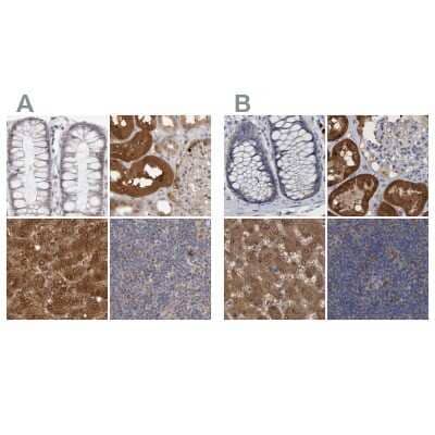 <b>Independent Antibodies Validation and Orthogonal Strategies Validation.</b>Immunohistochemistry-Paraffin: PNPO Antibody [NBP1-87302] - Staining of human colon, kidney, liver and lymph node using Anti-PNPO antibody NBP1-87302 (A) shows similar protein distribution across tissues to independent antibody NBP1-87303 (B).