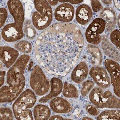 Immunohistochemistry-Paraffin: PNPO Antibody [NBP1-87303] - Immunohistochemical staining of human kidney shows strong positivity in cells in tubules.