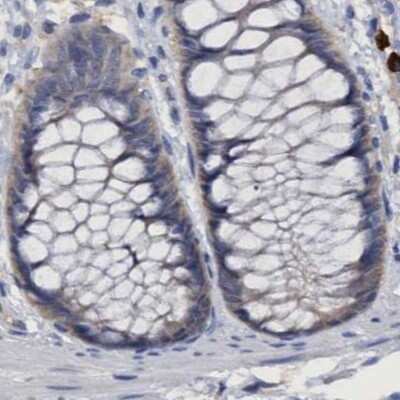 Immunohistochemistry-Paraffin: PNPO Antibody [NBP1-87303] - Staining of human colon.