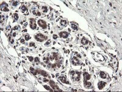 Immunohistochemistry: PNPO Antibody (OTI1G9) [NBP2-45361] - Analysis of Human breast tissue.