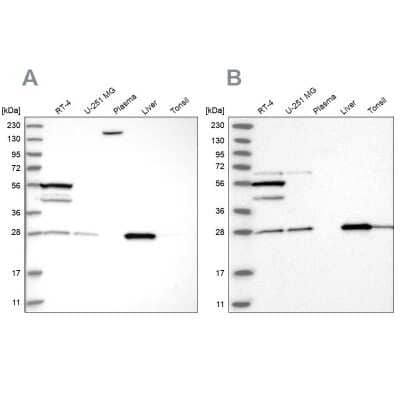 Western Blot: PNPO Antibody [NBP1-87303] - Analysis using Anti-PNPO antibody NBP1-87303 (A) shows similar pattern to independent antibody NBP1-87302 (B).