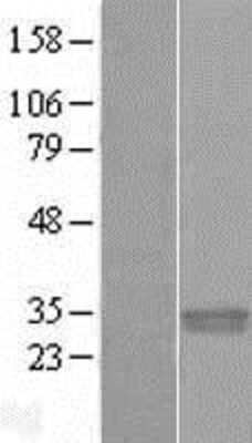 Western Blot: PNPO Overexpression Lysate (Adult Normal) [NBL1-14559] Left-Empty vector transfected control cell lysate (HEK293 cell lysate); Right -Over-expression Lysate for PNPO.