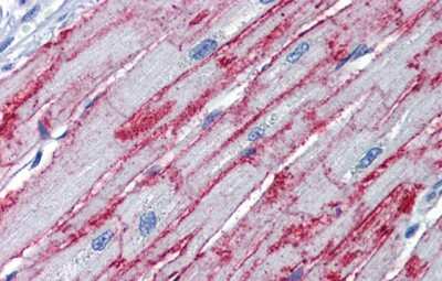Immunohistochemistry-Paraffin: PNPT1 Antibody [NBP1-57179] - Human Heart Tissue, antibody concentration 5.0ug/ml.