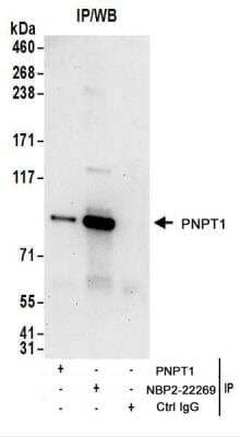 <b>Biological Strategies Validation. </b>Immunoprecipitation: PNPT1 Antibody [NBP2-22269] - Whole cell lysate (1 mg for IP; 20% of IP loaded) from 293T cells.  Antibodies:  NBP2-22269 used for IP at 6 ug/mg lysate.  PNPT1 was also immunoprecipitated by rabbit anti-PNPT1  antibody.  For blotting immunoprecipitated PNPT1, NBP2-22269 was used at 1 ug/ml.  Detection: Chemiluminescence with an exposure time of 30 seconds.