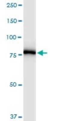 Western Blot: PNPT1 Antibody [H00087178-D01P] - Analysis of PNPT1 expression in A-431.