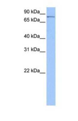 Western Blot: PNPT1 Antibody [NBP1-57179] - Hela tissue lysate at a concentration of 0.5ug/ml.