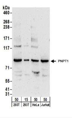 Western Blot: PNPT1 Antibody [NBP2-22269] - Whole cell lysate from 293T (15 and 50 ug), HeLa (50 ug),  and Jurkat (50 ug) cells.  NBP2-22269 used for WB at 0.4 ug/ml.  Detection: Chemiluminescence with an exposure time of 3 minutes.