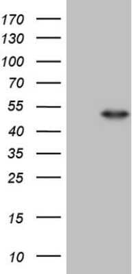 Western Blot: PNR/NR2E3 Antibody (OTI3D4) - Azide and BSA Free [NBP2-73510] - Analysis of HEK293T cells were transfected with the pCMV6-ENTRY control (Left lane) or pCMV6-ENTRY NR2E3.