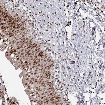 Immunohistochemistry-Paraffin: PNRC2 Antibody [NBP2-46721] - Staining of human urinary bladder shows strong nuclear positivity in urothelial cells.