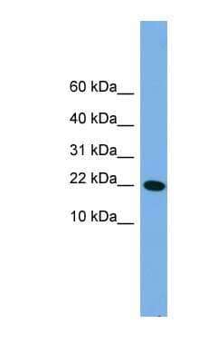 Western Blot: PNRC2 Antibody [NBP1-79660] - Hela cell lysate, concentration 0.2-1 ug/ml.