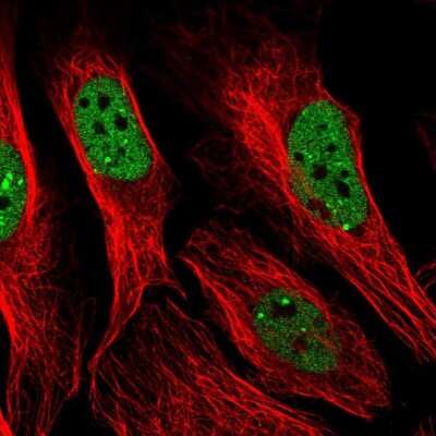 Immunocytochemistry/Immunofluorescence: PNUTS/PPP1R10 Antibody [NBP2-38565] - Staining of human cell line U-2 OS shows localization to nucleoplasm & nuclear bodies.
