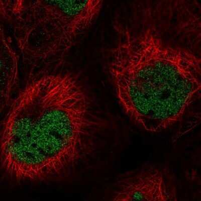 Immunocytochemistry/Immunofluorescence: PNUTS/PPP1R10 Antibody [NBP2-38801] - Immunofluorescent staining of human cell line A-431 shows localization to nucleoplasm.