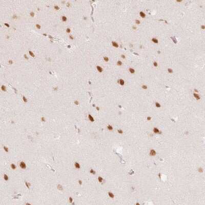 Immunohistochemistry: PNUTS/PPP1R10 Antibody [NBP2-38565] - Staining of human cerebral cortex shows strong nuclear positivity in neuronal cells.