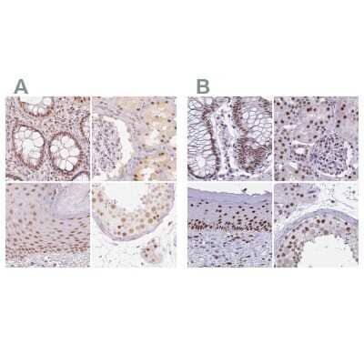 <b>Independent Antibodies Validation. </b>Immunohistochemistry-Paraffin: PNUTS/PPP1R10 Antibody [NBP2-38565] - Staining of human colon, kidney, skin and testis using Anti-PPP1R10 antibody NBP2-38565 (A) shows similar protein distribution across tissues to independent antibody NBP2-38801 (B).