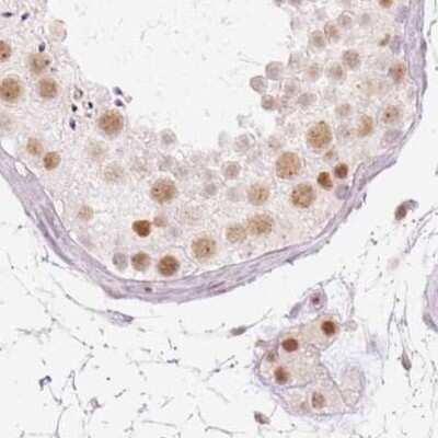 Immunohistochemistry-Paraffin: PNUTS/PPP1R10 Antibody [NBP2-38565] - Staining of human testis.
