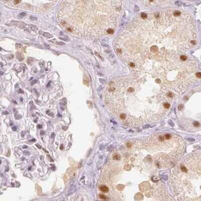 Immunohistochemistry-Paraffin: PNUTS/PPP1R10 Antibody [NBP2-38565] - Staining of human kidney.