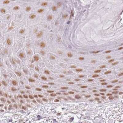 Immunohistochemistry-Paraffin: PNUTS/PPP1R10 Antibody [NBP2-38565] - Staining of human skin.