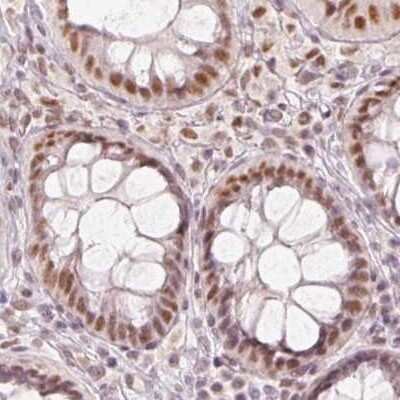Immunohistochemistry-Paraffin: PNUTS/PPP1R10 Antibody [NBP2-38565] - Staining of human colon.