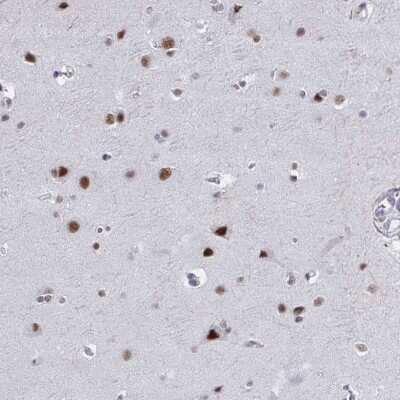 Immunohistochemistry-Paraffin: PNUTS/PPP1R10 Antibody [NBP2-38801] - Staining of human cerebral cortex shows strong nuclear positivity in neuronal cells.