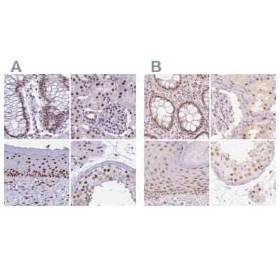 <b>Independent Antibodies Validation. </b>Immunohistochemistry-Paraffin: PNUTS/PPP1R10 Antibody [NBP2-38801] - Staining of human colon, kidney, skin and testis using Anti-PPP1R10 antibody NBP2-38801 (A) shows similar protein distribution across tissues to independent antibody NBP2-38565 (B).