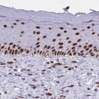Immunohistochemistry-Paraffin: PNUTS/PPP1R10 Antibody [NBP2-38801] - Staining of human skin.