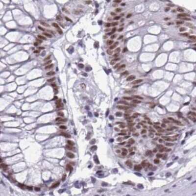 Immunohistochemistry-Paraffin: PNUTS/PPP1R10 Antibody [NBP2-38801] - Staining of human colon.