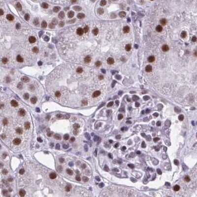 Immunohistochemistry-Paraffin: PNUTS/PPP1R10 Antibody [NBP2-38801] - Staining of human kidney.