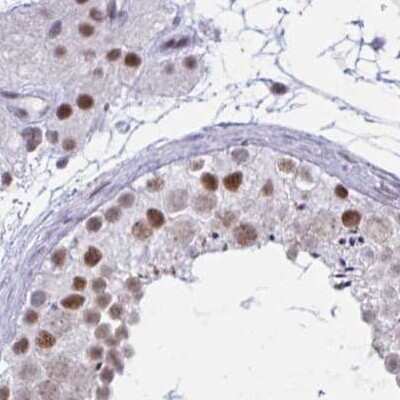 Immunohistochemistry-Paraffin: PNUTS/PPP1R10 Antibody [NBP2-38801] - Staining of human testis.
