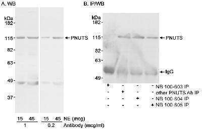 Western Blot: PNUTS/PPP1R10 Antibody [NB100-604] - Detection of Human PNUTS on HeLa whole cell lysates using NB100-604. IP of PNUTS was successfully performed with NB100-603, NB100-605, and another PNUTS polyclonal. IPed PNUTS was blotted using NB100-605.