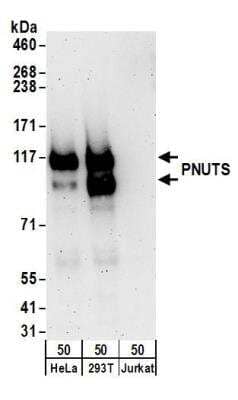 Western Blot: PNUTS/PPP1R10 Antibody [NB100-604] - Detection of Human PNUTS by Western Blot. Samples: Whole cell lysate (50 ug) from HeLa, 293T, and Jurkat cells. Antibodies: Affinity purified rabbit anti-PNUTS antibody NB100-604 used for WB at 0.1 ug/ml. Detection: Chemiluminescence with an exposure time of 3 minutes.