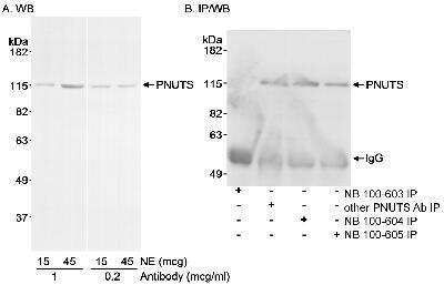 <b>Independent Antibodies Validation and Biological Strategies Validation.</b>Western Blot: PNUTS/PPP1R10 Antibody [NB100-605] - Detection of Human PNUTS on HeLa whole cell lysates usings NB100-605. IP of PNUTS was successfully performed with NB100-603, NB100-604, and another PNUTS polyclonal. IPed PNUTS was blotted using NB100-605