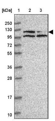 Western Blot: PNUTS/PPP1R10 Antibody [NBP2-38565] - Lane 1: Marker  [kDa] 250, 130, 95, 72, 55, 36, 28, 17, 10.  Lane 2: Human cell line RT-4.  Lane 3: Human cell line U-251MG