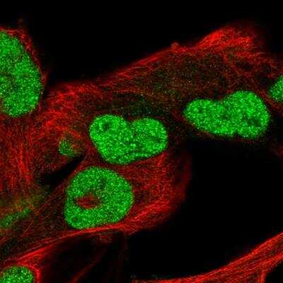 Immunocytochemistry/Immunofluorescence: POC5 Antibody [NBP2-76555] - Staining of human cell line RH-30 shows localization to nucleus. Antibody staining is shown in green.