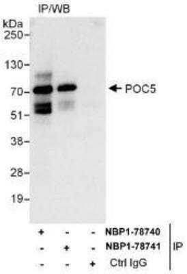 Immunoprecipitation: POC5 Antibody [NBP1-78741] - Whole cell lysate (1 mg for IP, 20 percent of IP loaded) from Jurkat cells.  Antibodies: Affinity purified rabbit anti-POC5 antibody NBP1-78741 used for IP at 6 ug/mg lysate.  POC5 was also immunoprecipitated by rabbit anti-POC5 antibody NBP1-78740, which recognizes an upstream epitope.  For blotting immunoprecipitated POC5, NBP1-78740 was used at 0.4 ug/ml.  Detection: Chemiluminescence with an exposure time of 10 seconds.