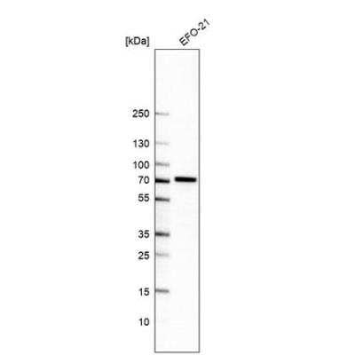 Western Blot: POC5 Antibody [NBP2-76534] - Analysis in human cell line EFO-21.