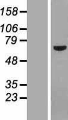 Western Blot: POC5 Overexpression Lysate (Adult Normal) [NBP2-05381] Left-Empty vector transfected control cell lysate (HEK293 cell lysate); Right -Over-expression Lysate for POC5.
