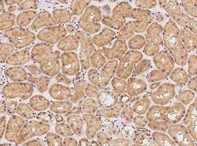 Immunohistochemistry-Paraffin PODNL1 Antibody - BSA Free