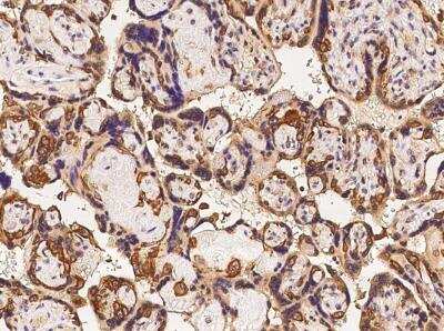 Immunohistochemistry-Paraffin PODNL1 Antibody - BSA Free