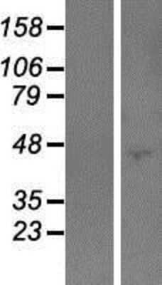 Western Blot: PODNL1 Overexpression Lysate (Adult Normal) [NBP2-06279] Left-Empty vector transfected control cell lysate (HEK293 cell lysate); Right -Over-expression Lysate for PODNL1.