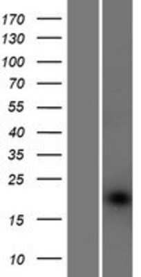 Western Blot: POFUT1 Overexpression Lysate (Adult Normal) [NBP2-05172] Left-Empty vector transfected control cell lysate (HEK293 cell lysate); Right -Over-expression Lysate for POFUT1.