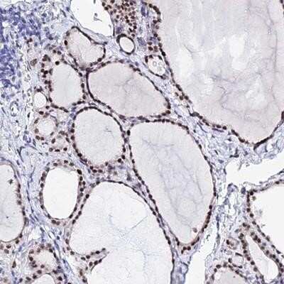 Immunohistochemistry-Paraffin: POFUT2 Antibody [NBP1-92279] - Staining of human thyroid gland shows moderate nuclear positivity in glandular cells.